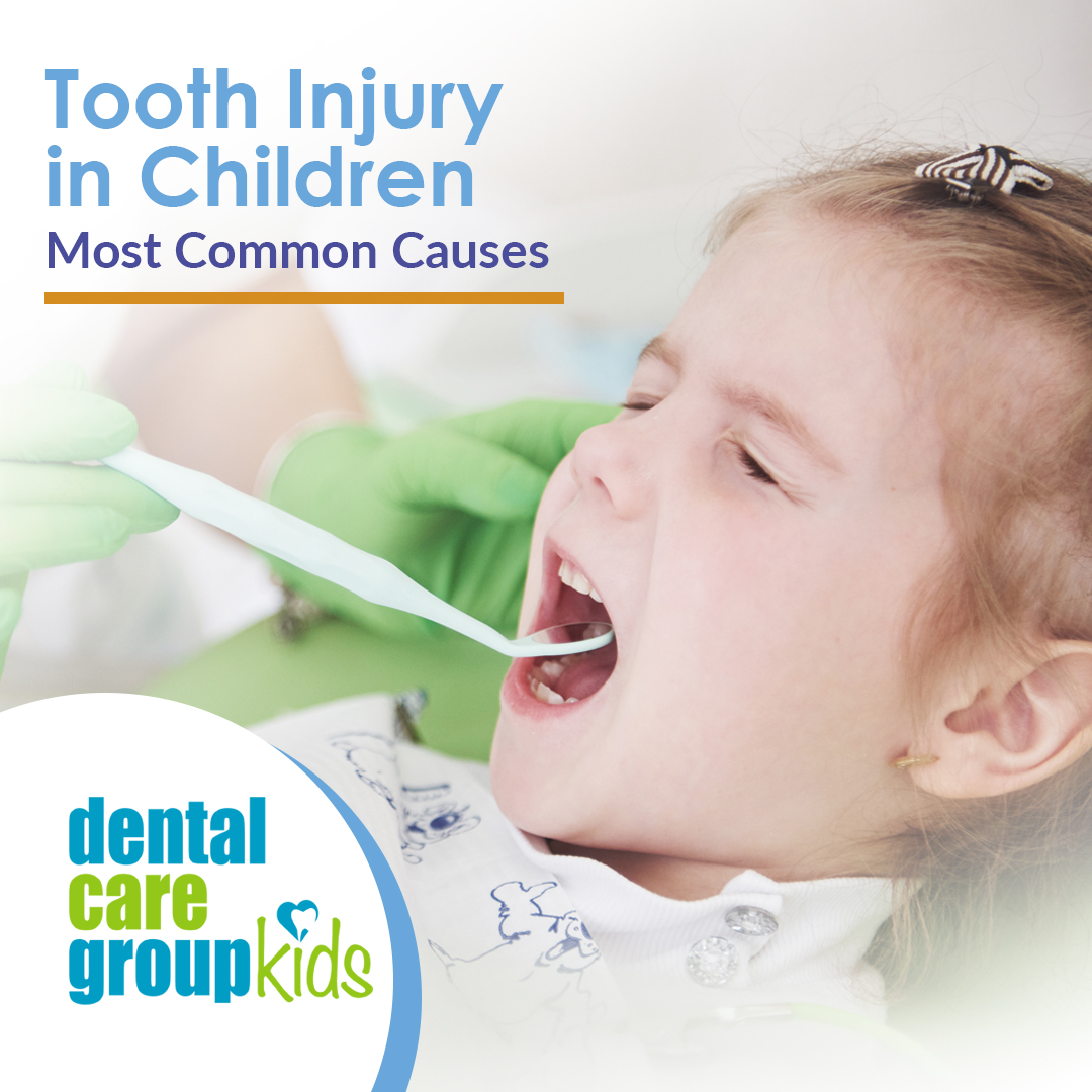 The Dental Care Group | Blog | Help, I broke my Tooth!