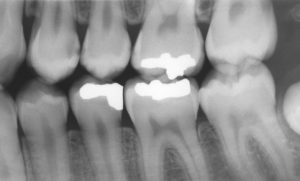 Dental Care Group dental x-ray