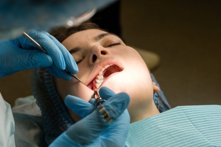 wisdom tooth removal procedure